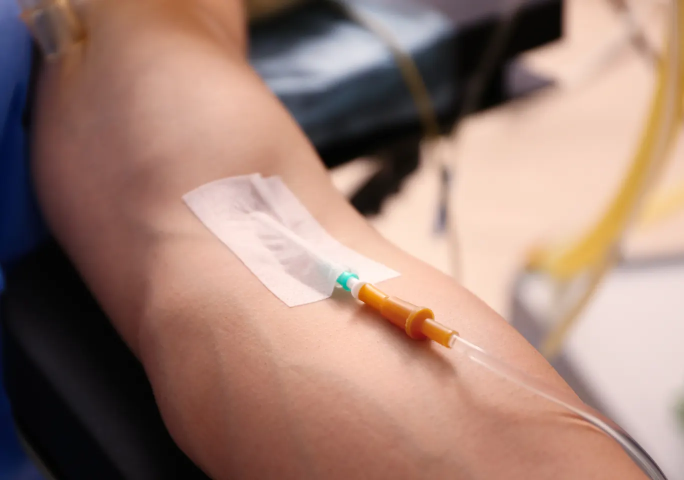 Kroplówki witaminowe Zielona Góra: przedramię z kaniulą i przezroczystym opatrunkiem